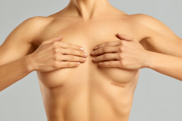Comment masser le tissu cicatriciel après une chirurgie mammaire ?
